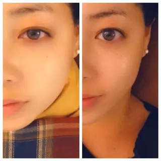 Relama 美容鍼×マッサージ所属・Relama/リラマ 美容鍼×マッサージのエステ・リラクイメージ