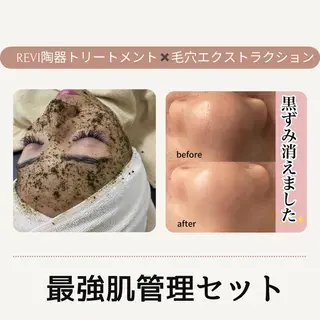 ■超絶小顔＆肌管理室■所属・🦋整形級の究極美顔 本格韓国式小顔🦋のエステ・リラクイメージ