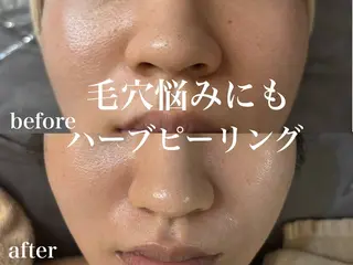 WHITE AQUA 北千住店のエステ・リラクイメージ