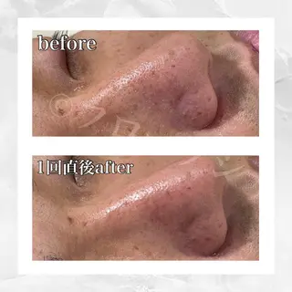 部分痩せ♥️小顔専門 MIKUのエステ・リラクイメージ