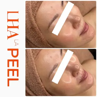 ハーブピーリング専門 BIOEL横浜のエステ・リラクイメージ