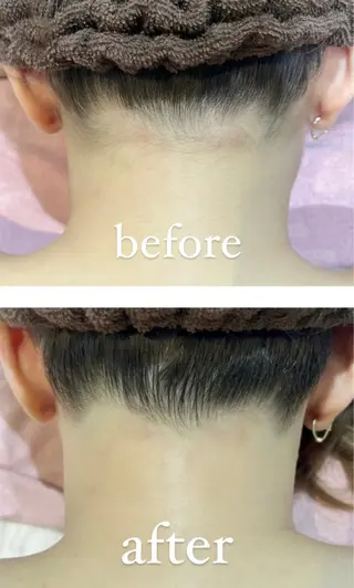 RAY Beauty エステ 一宮店のエステ・リラクイメージ