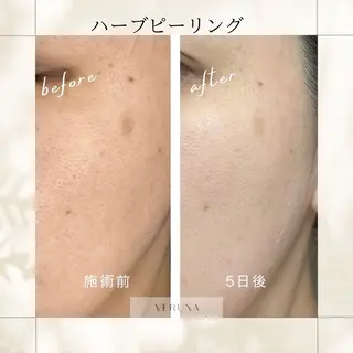 ピーリング専門店 Belluteのエステ・リラクイメージ