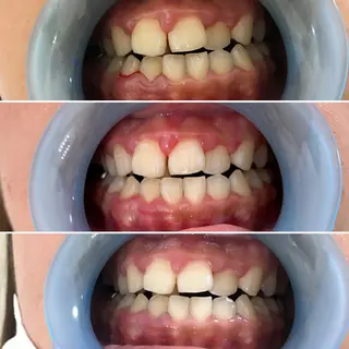 217whitening  room所属・217 ホワイトニングルームのエステ・リラクイメージ