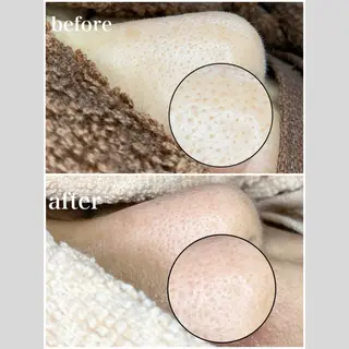 韓国肌管理 【毛穴専科】のエステ・リラクイメージ