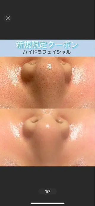 ココルアナ橋本店所属・ココルアナ 橋本店のエステ・リラクイメージ