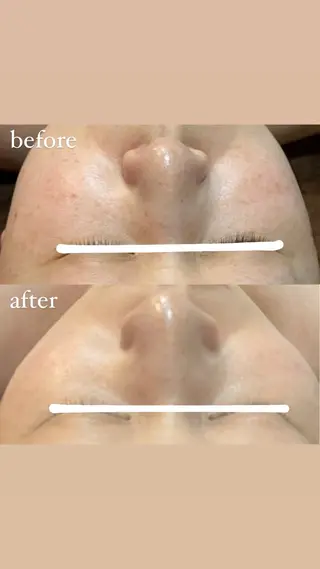 brilliance所属・老化肌トラブル肌専門 Brillianceのエステ・リラクイメージ