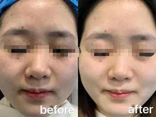 カラー パーマ ヘアアレンジ メンズ キッズ ネイル マツエク・マツパ アイブロウ Einami 美肌痩身サロンのエステ・リラクイメージ