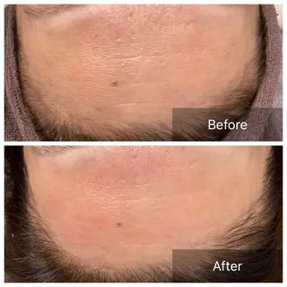 産毛専門店 Bittoのエステ・リラクイメージ