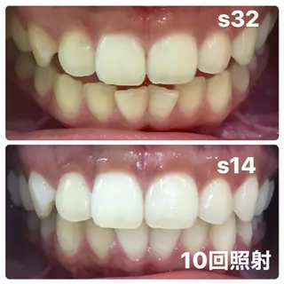 LOVEホワイトニング表参道店所属・LOVE ホワイトニング表参道のその他イメージ