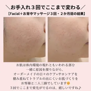 PRETTIEST SHINE所属・山田 浩子のエステ・リラクイメージ