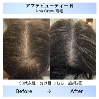 メンズ 痩身小顔専門 アマテ ビューティー.Nのエステ・リラクイメージ