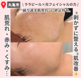 前山 くるみのエステ・リラクイメージ
