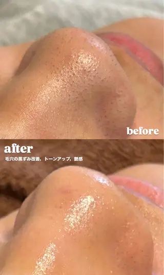 メンズ 脱毛・フェイシャルエステ専門サロン　NUXS SAKAE所属・NUXS SAKAEのエステ・リラクイメージ