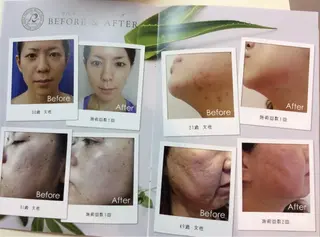 ジョリ   ヴェール 山口のマツエク・マツパデザイン