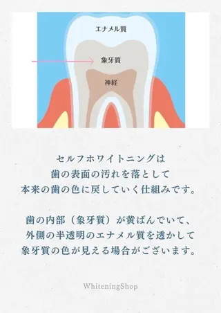 ホワイトニングショップ静岡葵区店所属・ホワイトニング ショップ静岡葵区店のその他イメージ