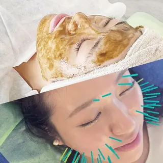 小顔美容鍼専門サロン 渋谷YZのエステ・リラクイメージ