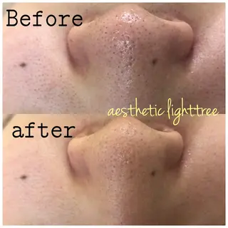 ショート カラー パーマ ヘアアレンジ メンズ キッズ ニキビ&跡改善サロン オーナー光木のエステ・リラクイメージ