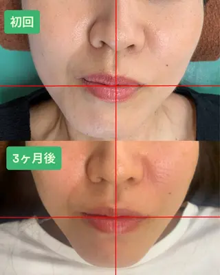 河輪 鍼灸接骨院のエステ・リラクイメージ