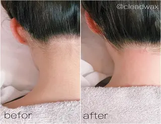 CLEAD赤坂見附店 坂田のエステ・リラクイメージ