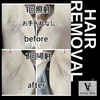 メンズ ネイル ATTO SHIORIのエステ・リラクイメージ