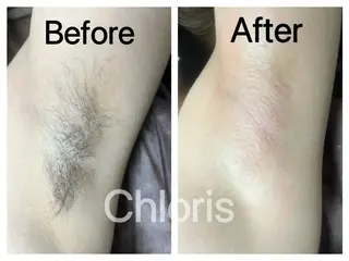 川越ローマピンク 光脱毛＆ワックス脱毛のエステ・リラクイメージ