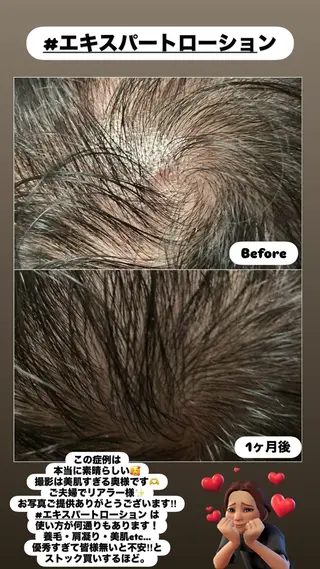 LiZA エステティックサロンのエステ・リラクイメージ