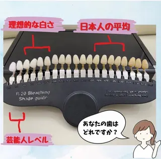 ホワイトニングショップ伊丹店所属・ホワイトニング ショップ伊丹店のその他イメージ