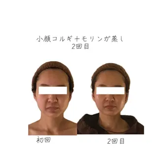 小顔コルギ専門店/隠れ家サロン《여름ヨルム》所属・小顔コルギ専門店 《ヨルム》龍ケ崎店のエステ・リラクイメージ
