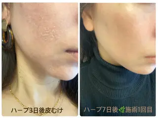 FLEUR大阪・整体 ・ハイフ・痩身・小顔のエステ・リラクイメージ