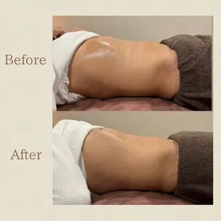 お腹痩せエステ Flat BELLY 恵比寿所属・【腸もみ/冷却痩身】 お腹エステ/恵比寿のエステ・リラクイメージ