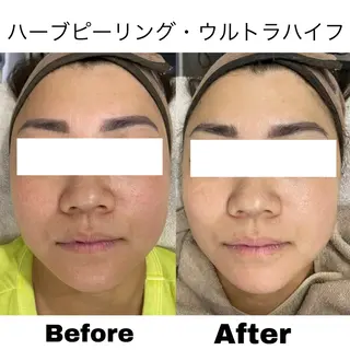 美肌サロンTIAM by tetoteのエステ・リラクイメージ