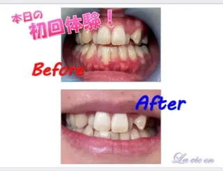 セルフホワイトニングサロン　ラヴィアン所属・ホワイトニングサロン La vie enのその他イメージ