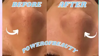 POWER OF BEAUTY所属・🎀TOMO🎀 “””のエステ・リラクイメージ