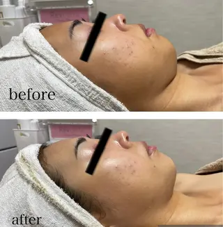 B.glossy所属・ビューティーサロン B.glossyのネイルデザイン