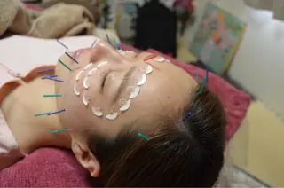 美容鍼灸女性専用 りんご鍼灸治療院のその他イメージ