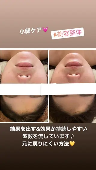 FLEUR大阪・整体 ・ハイフ・痩身・小顔のエステ・リラクイメージ