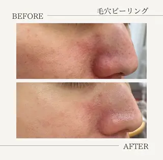 肌育成サロン ♡ 村田理紗のエステ・リラクイメージ