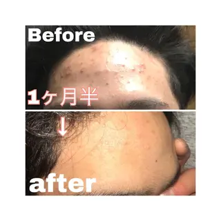 skinLabo所属・saya Mのエステ・リラクイメージ