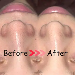 脱毛/毛穴ケア/小顔 博多アンドナイン平尾の眉毛・アイブロウイメージ