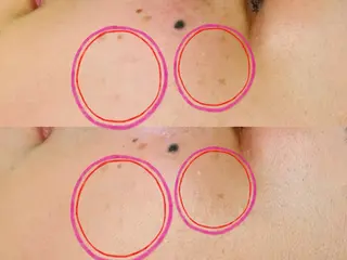 LukeBeauty salonのエステ・リラクイメージ