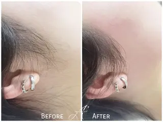 A*[エースター] シュガーリング🍋のエステ・リラクイメージ