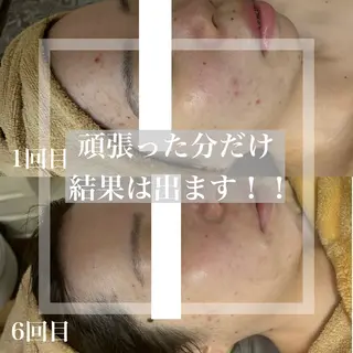 WHITE AQUA 北千住店のエステ・リラクイメージ