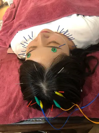 美容鍼灸女性専用 りんご鍼灸治療院のその他イメージ