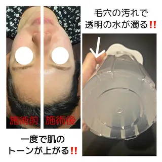 ハーブピーリング・毛穴ケア専門サロンSalon de LENA所属・ハーブピーリング 専門店/名古屋駅前店のエステ・リラクイメージ