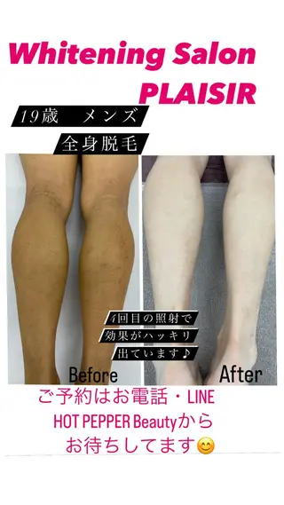 メンズ ホワイトニングサロン プレジールのエステ・リラクイメージ