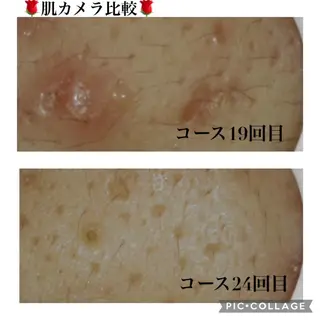 触れたくなる モテ肌へ...❤︎のエステ・リラクイメージ