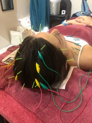 美容鍼灸女性専用 りんご鍼灸治療院のその他イメージ