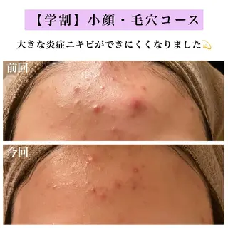 Bellesthe （ベルエステ）のエステ・リラクイメージ