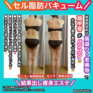 痩身/脱毛/ネイル HARUKAのエステ・リラクイメージ